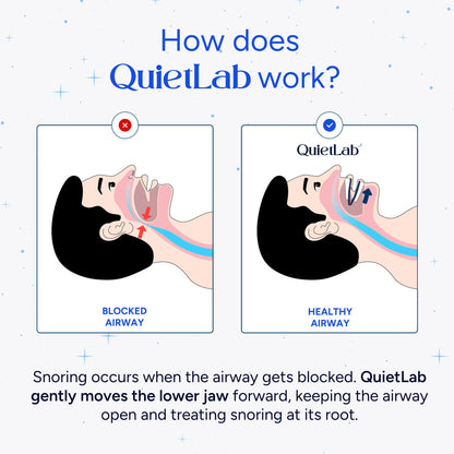 QuietLab Pro Anti-Snoring Mouthpiece